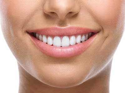 Smiling With perfect dental veneers